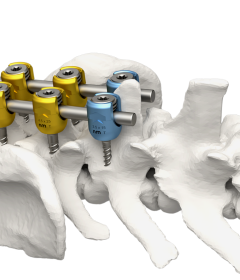 椎根釘固定系統 invetra™ Pedicle Screw Fixation System