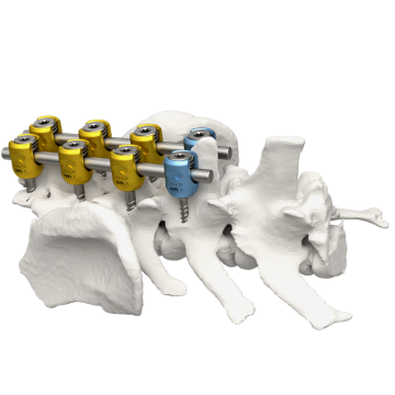 椎根釘固定系統 invetra™ Pedicle Screw Fixation System