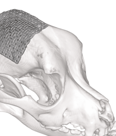 顱骨修補網片 neuromesh™