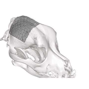 顱骨修補網片 neuromesh™ 